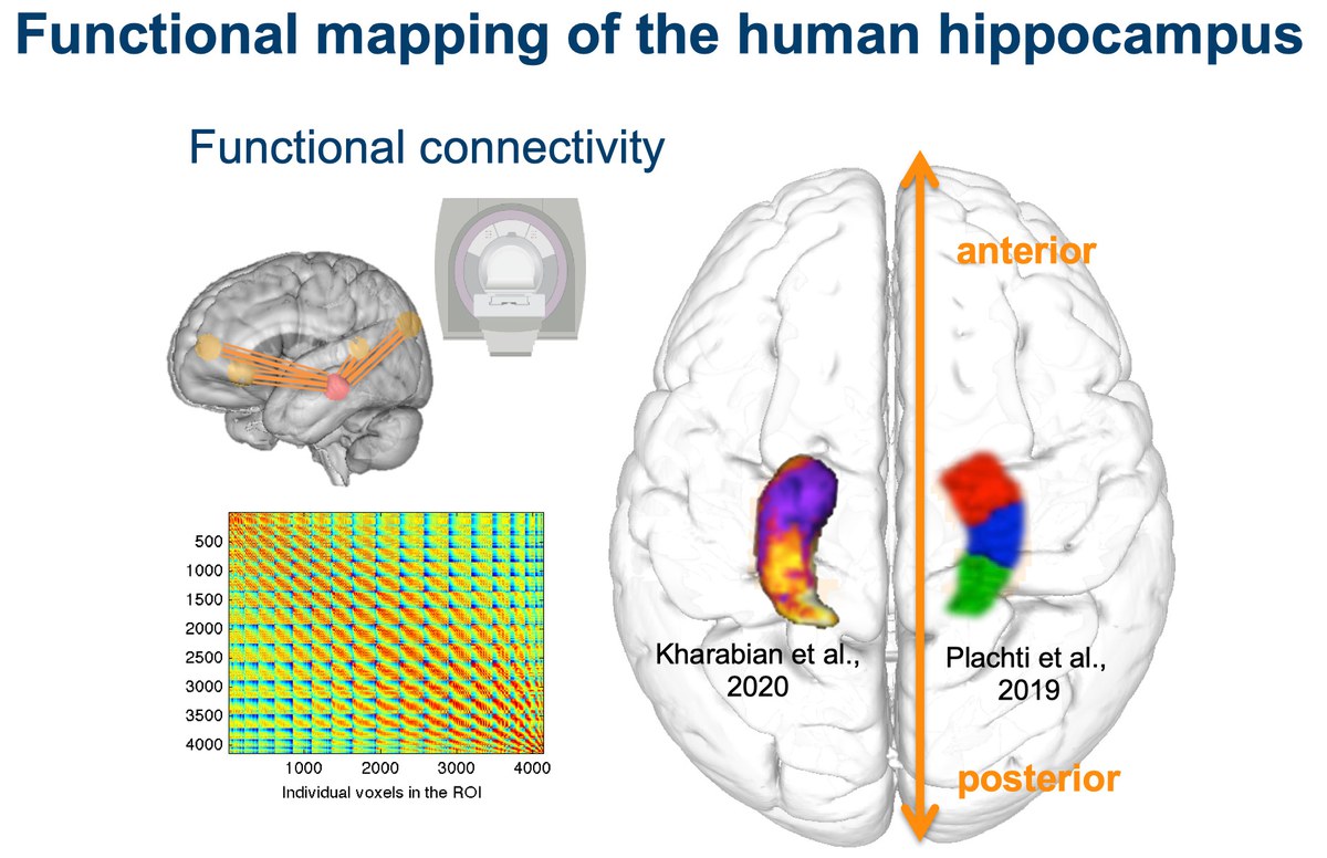 Kartierung von Struktur und Funktion des Hippocampus durch das Cognitive NeuroInformatics Lab